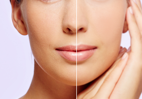 自然なデジタル修正